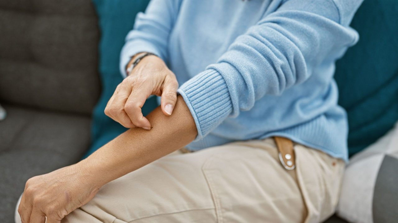 por-que-sentimos-coceira-so-de-ver-alguem-se-cocando?