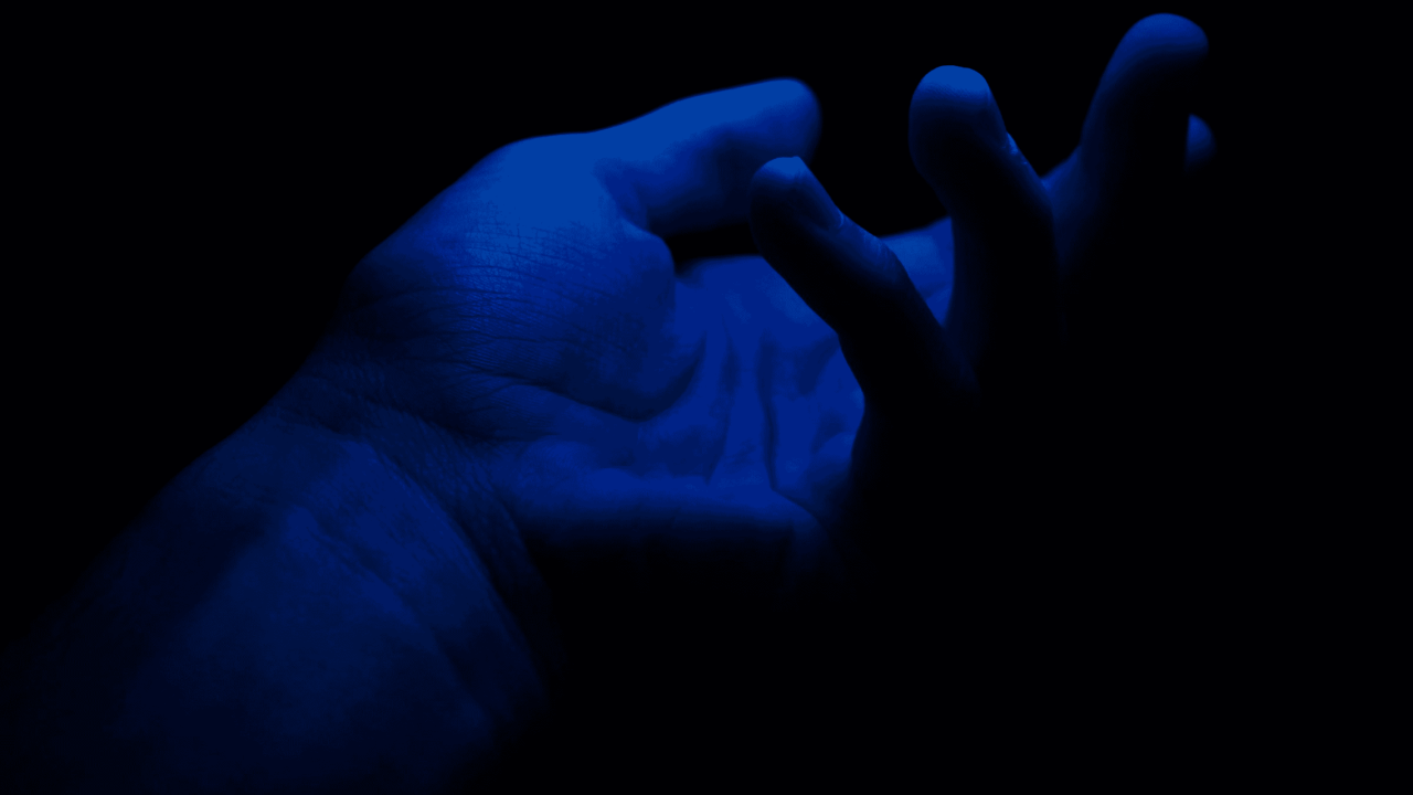 conheca-a-argiria,-a-doenca-que-deixa-a-pele-azul