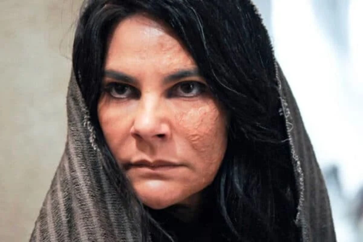 atriz-de-a-viagem-vive-reclusa-apos-queimar-o-corpo-em-gravacao