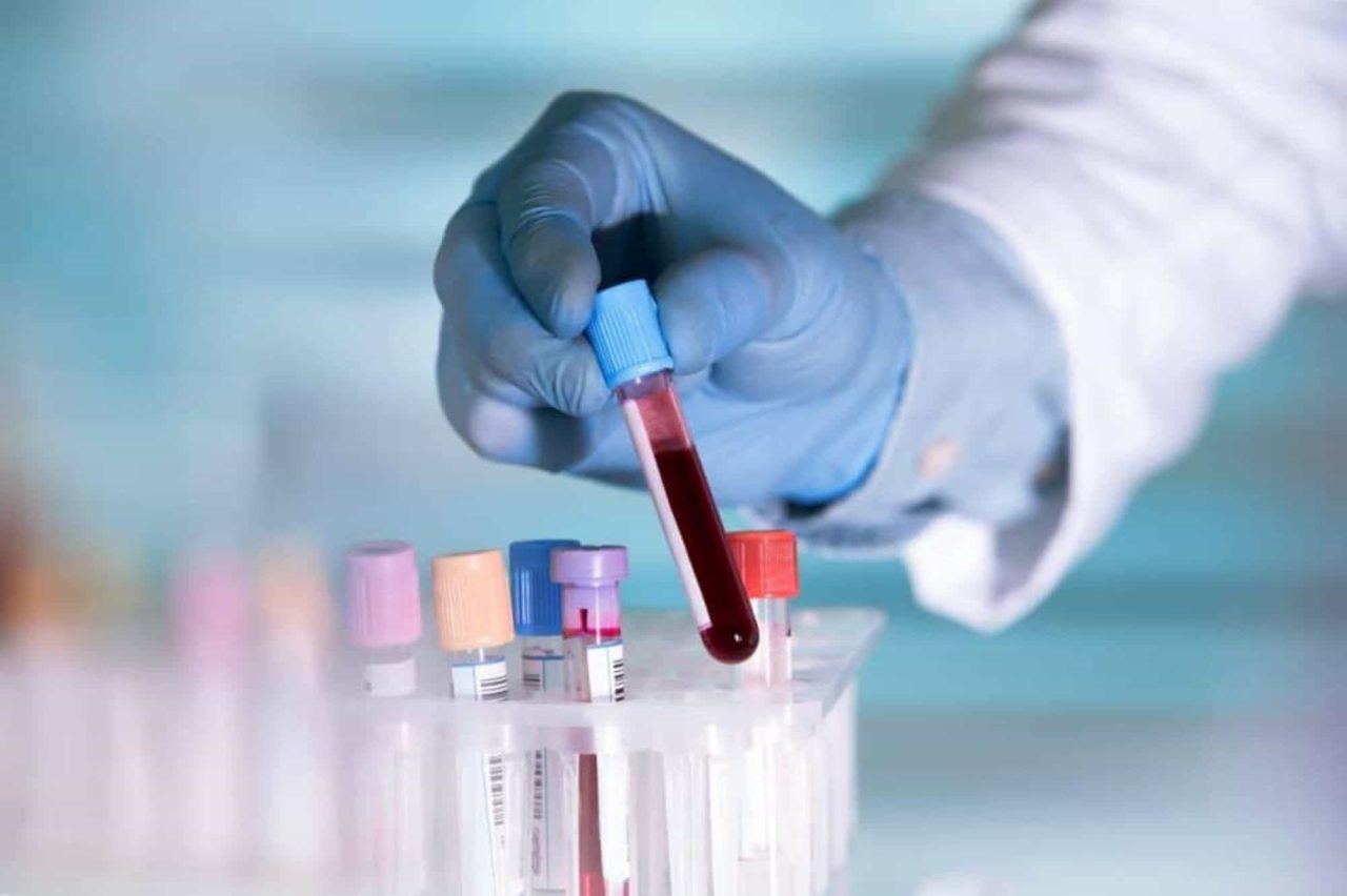 novo-exame-de-sangue-e-mais-agil-para-detectar-doencas-geneticas-em-criancas