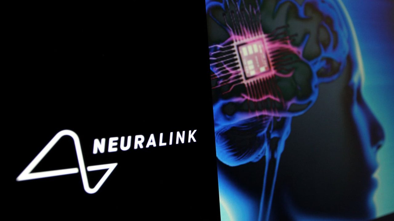 neuralink-capta-us$-650-milhoes-para-tornar-chips-cerebrais-mais-potentes