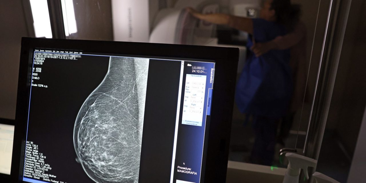 cancer-de-mama:-uma em-cada-tres pacientes tem-menos-de-50-anos