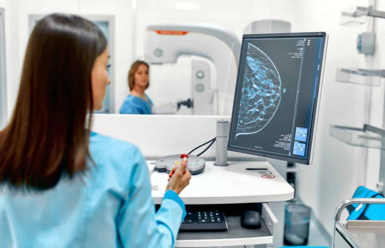 tecnologia-pode-detectar-retorno do-cancer-de-mama-com-antecedencia