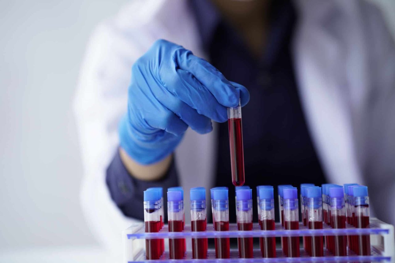 pesquisadores-descobrem-possivel-elo-entre-sangue-e-rejuvenescimento