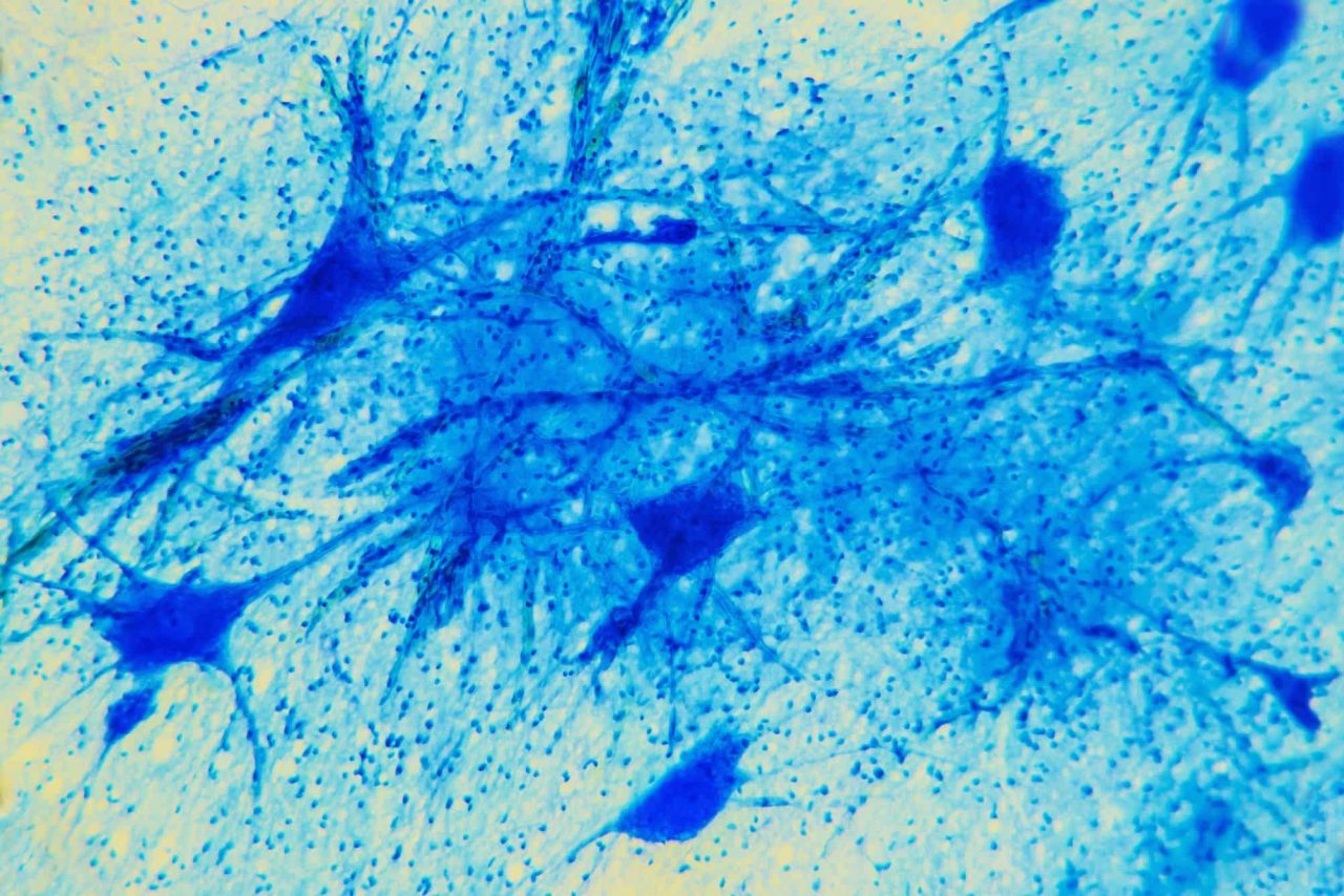 psicoterapia-provoca-mudancas-estruturais-no-cerebro,-aponta-estudo