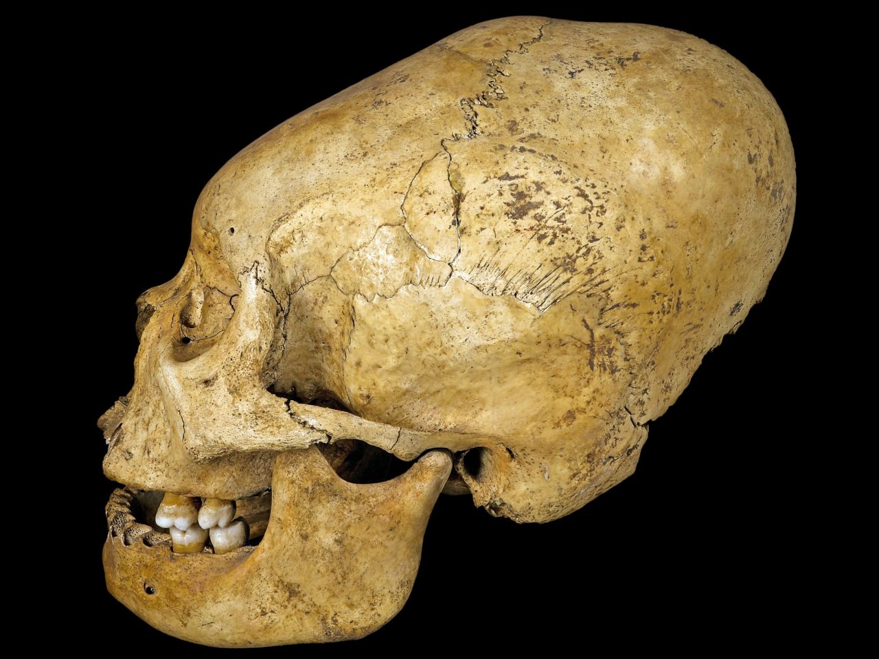 cranios-deformados-eram-simbolo-de-elite-ha-mil-anos,-diz-livro