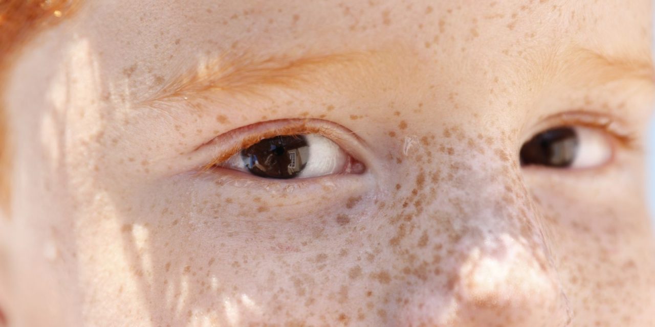 reflexo-branco-nos-olhos:-entenda-condicao-que-assusta-pais