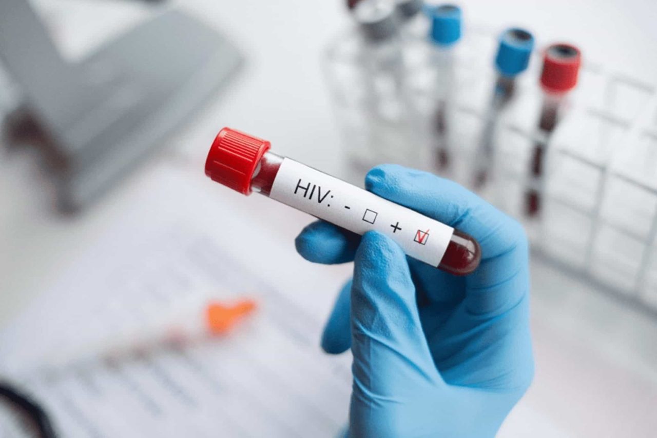 sus-pode-oferecer-terapia-injetavel-contra-o-hiv