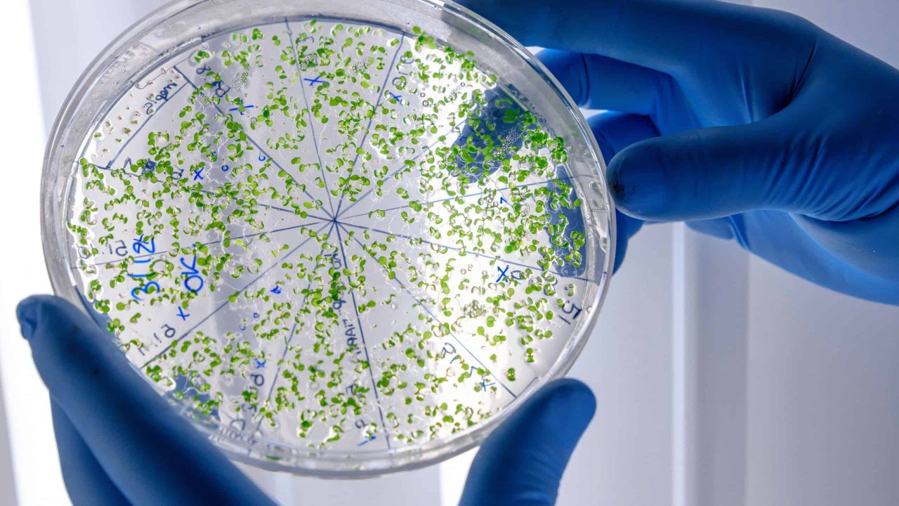 por-que-as-superbacterias-sao-tao-perigosas?