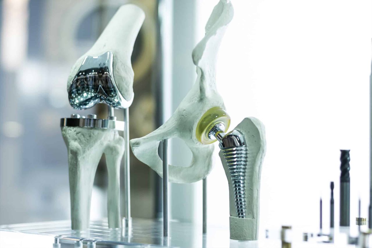 melhor-que-antibiotico?-metal-liquido-ajuda-a-combater-infeccoes-de-implantes-ortopedicos