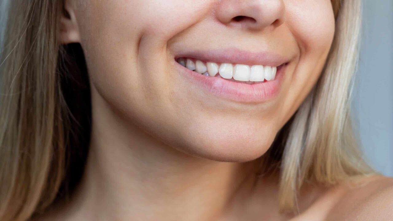 gel-revolucionario-e-capaz-de-reverter-a-erosao-do-esmalte-dentario