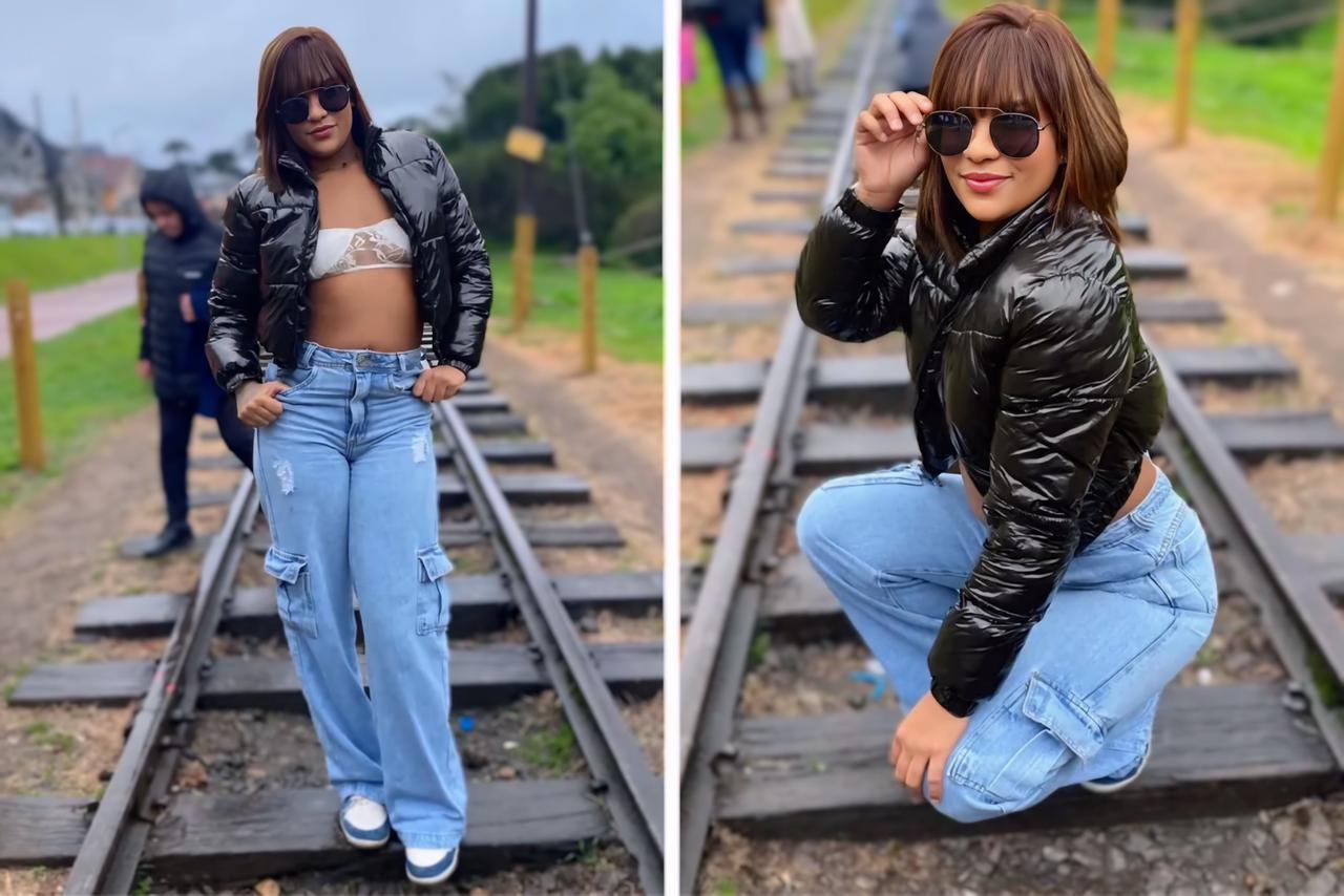 mulher-que-teve-pernas-amputadas-apos-ser-arrastada-passara-por-nova-cirurgia