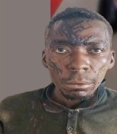 homem-e-preso-por-amputar-as-maos-da-esposa-por-ciumes