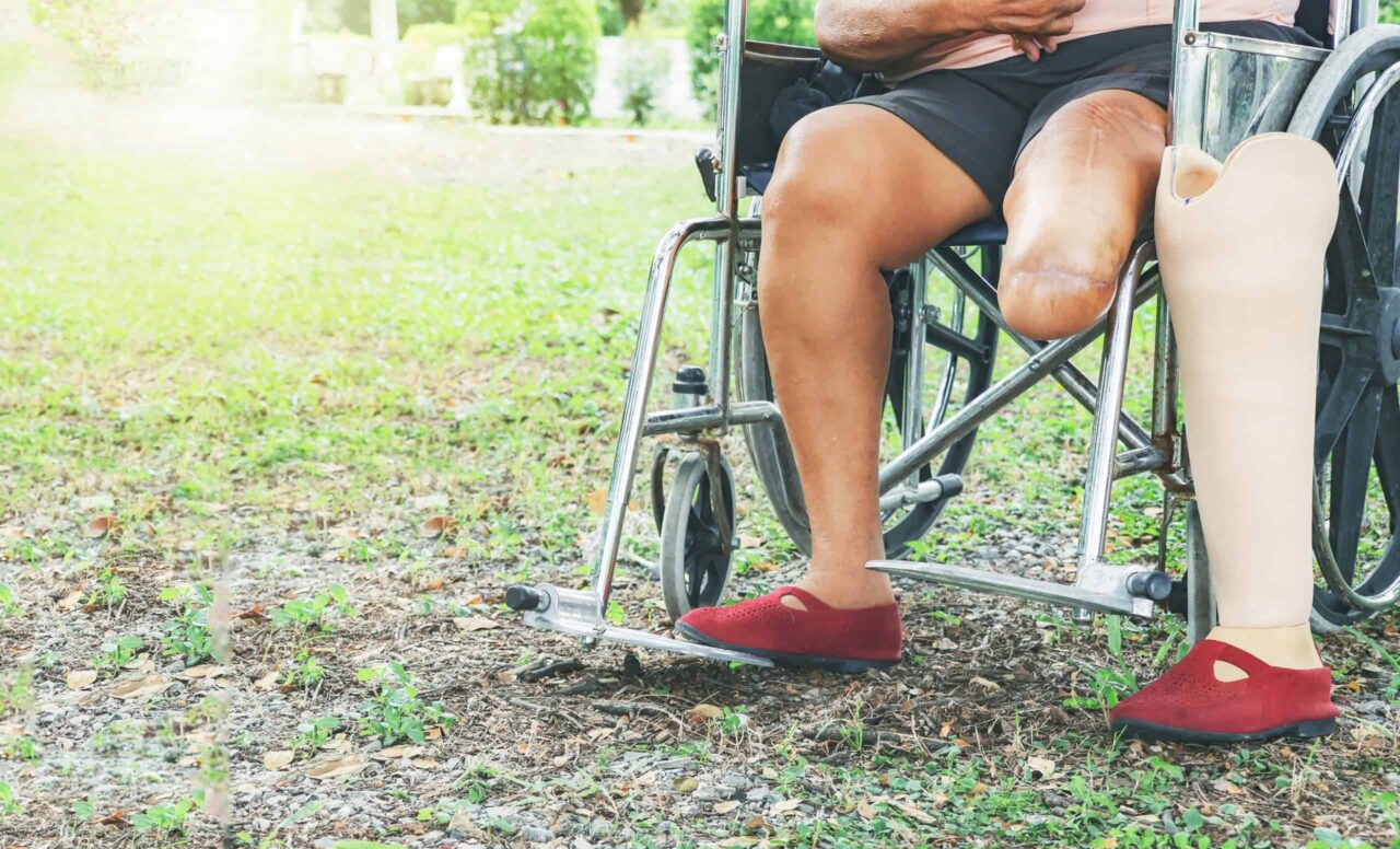 diabetes:-tecnologia-brasileira-pode-cortar-amputacoes-pela-metade