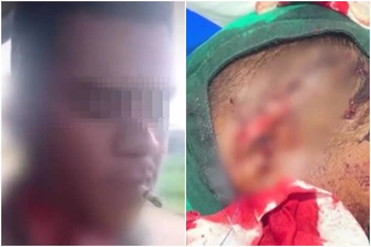 homem-tem-parte-da-orelha-decepada-durante-briga-de-bar