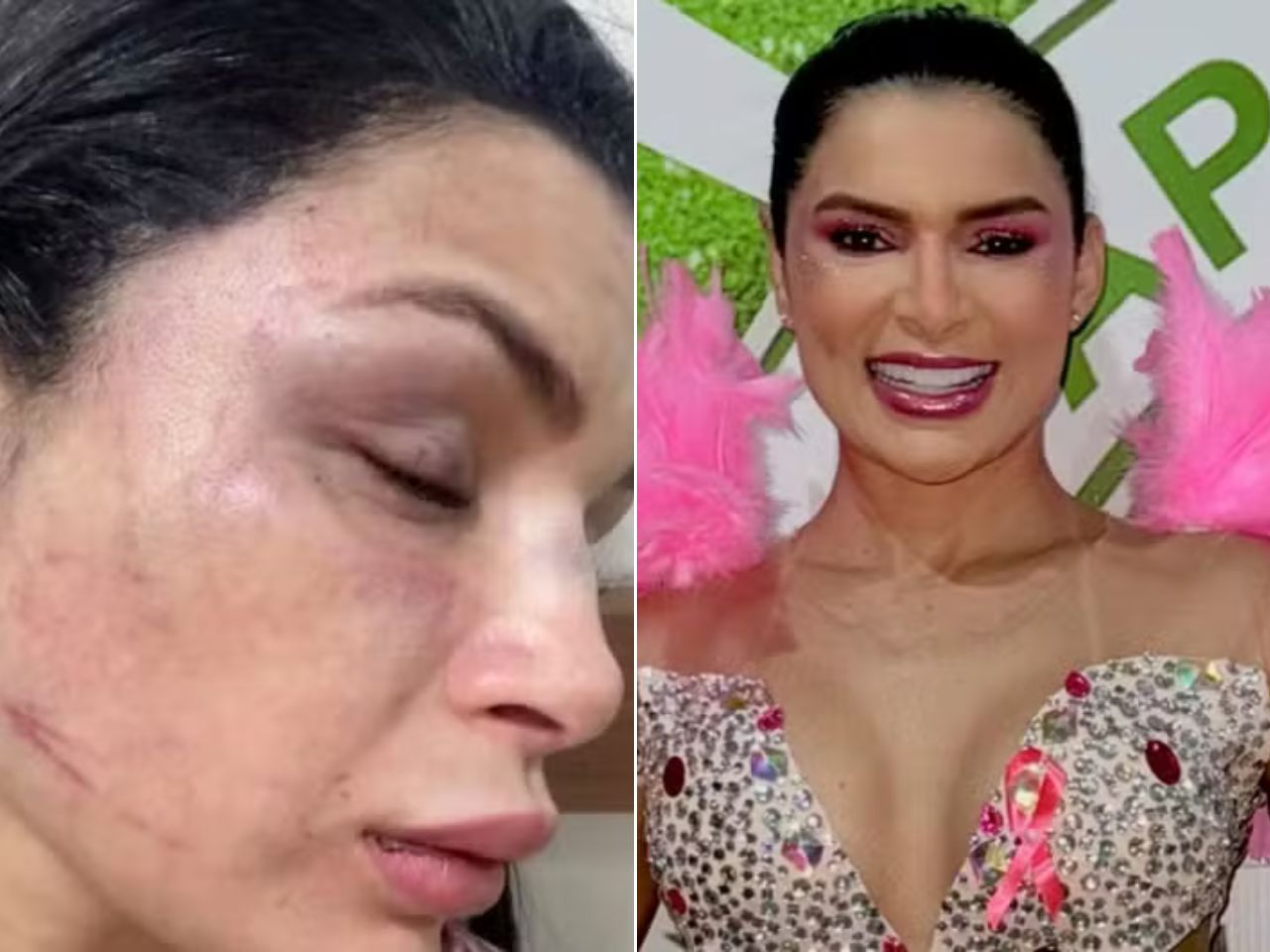 musa-de-escola-de-samba-da-nova-versao-apos-acusar-motorista-de-aplicativo-de-roubo-e-agressao