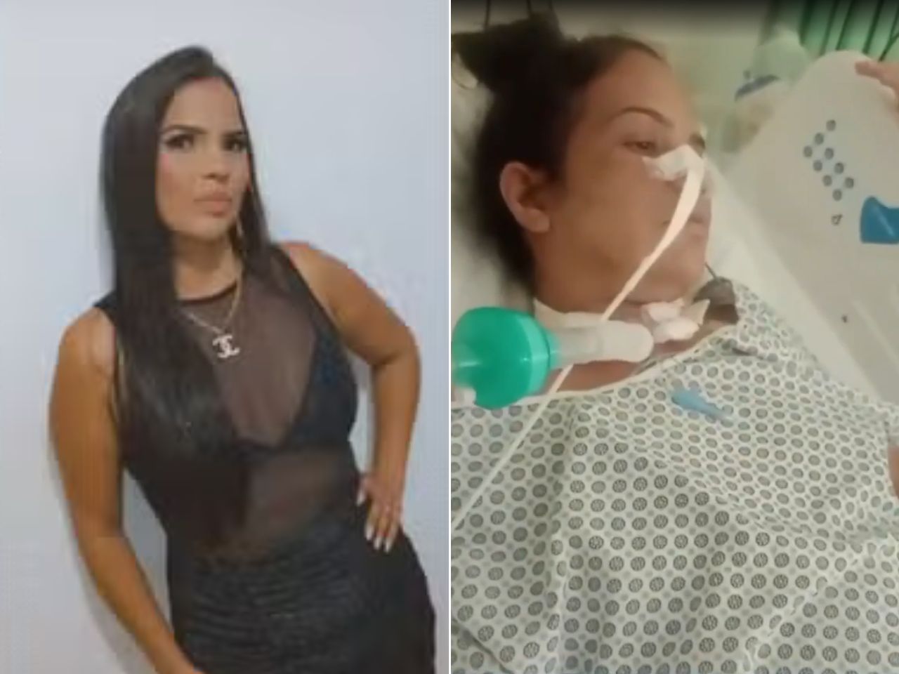 mulher-fica-em-estado-grave-apos-usar-caneta-emagrecedora-do-paraguai