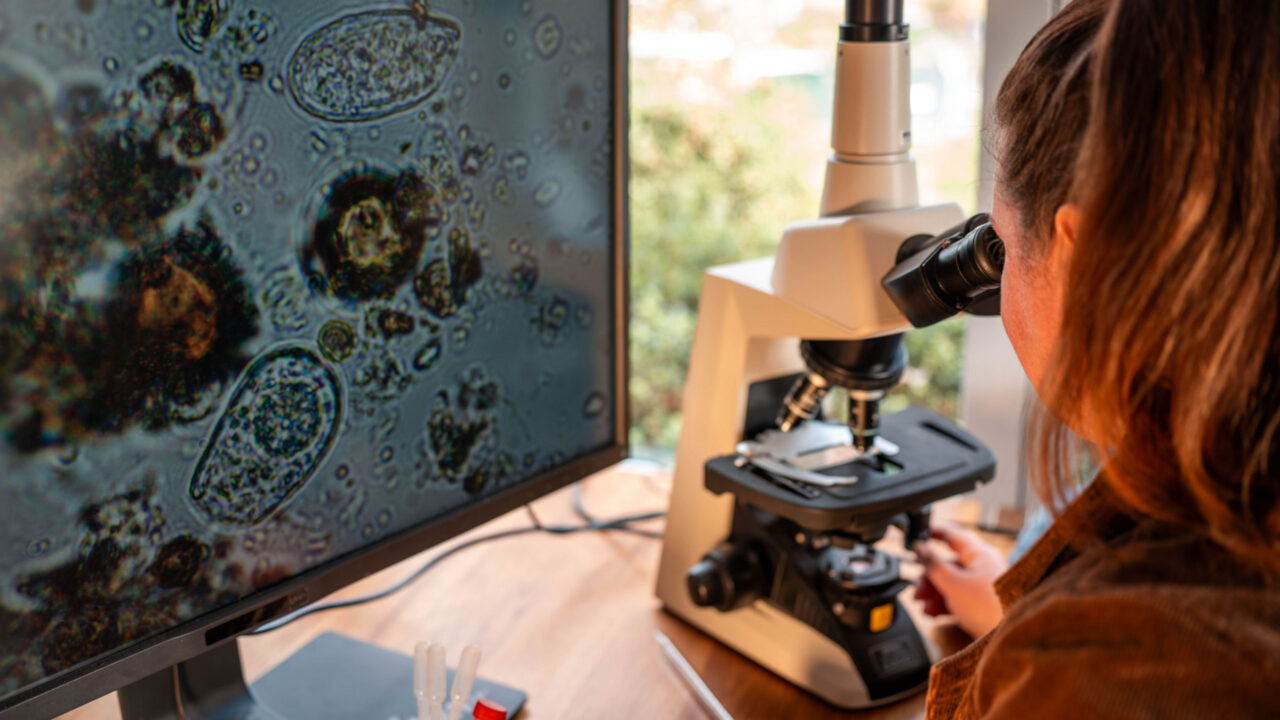 por-que-cientistas-estao-cada-vez-mais-preocupados-com-amebas?-entenda