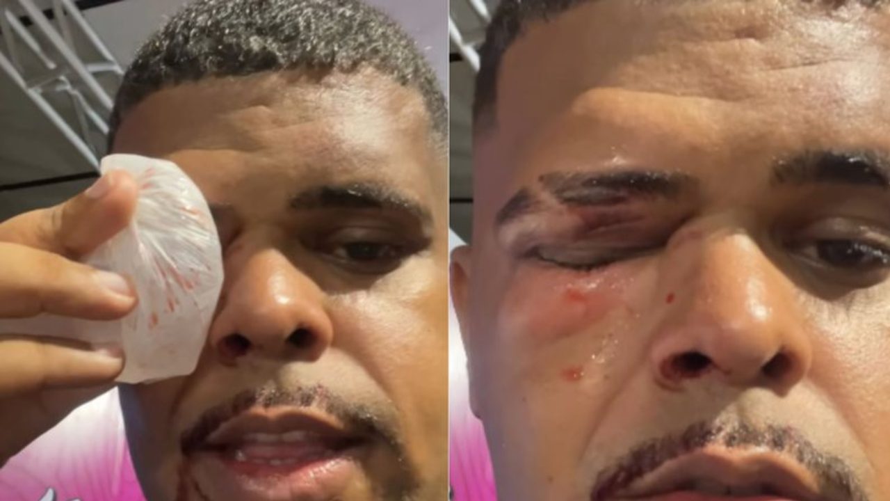 influenciador-e-agredido-durante-o-carnaval-de-salvador;-video