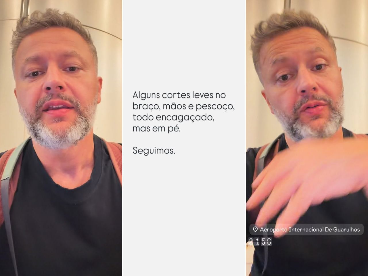 lucas-lima-fica-ferido-em-tentativa-de-assalto-a-caminho-do-aeroporto-em-sp